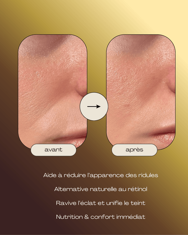 Sérum-Huile Anti-âge au Bakuchiol (Alternative Naturelle au Rétinol)-30ml