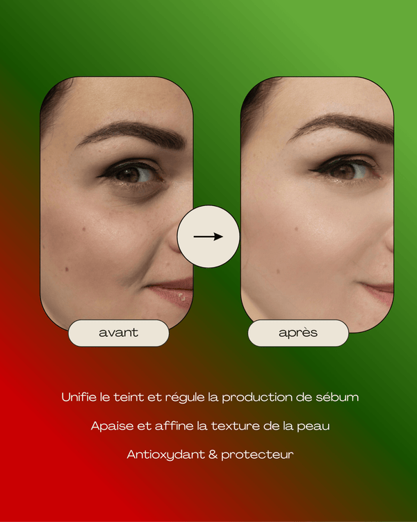 Gel perfecteur à la Niacinamide-50ml